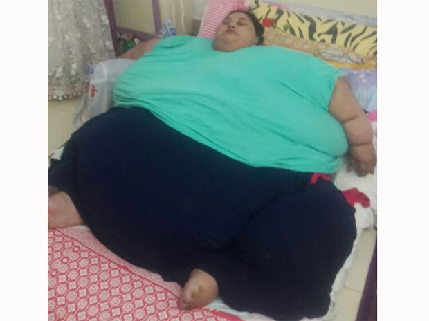 500kgegyptianwomantovisitindiasoonforsurgery